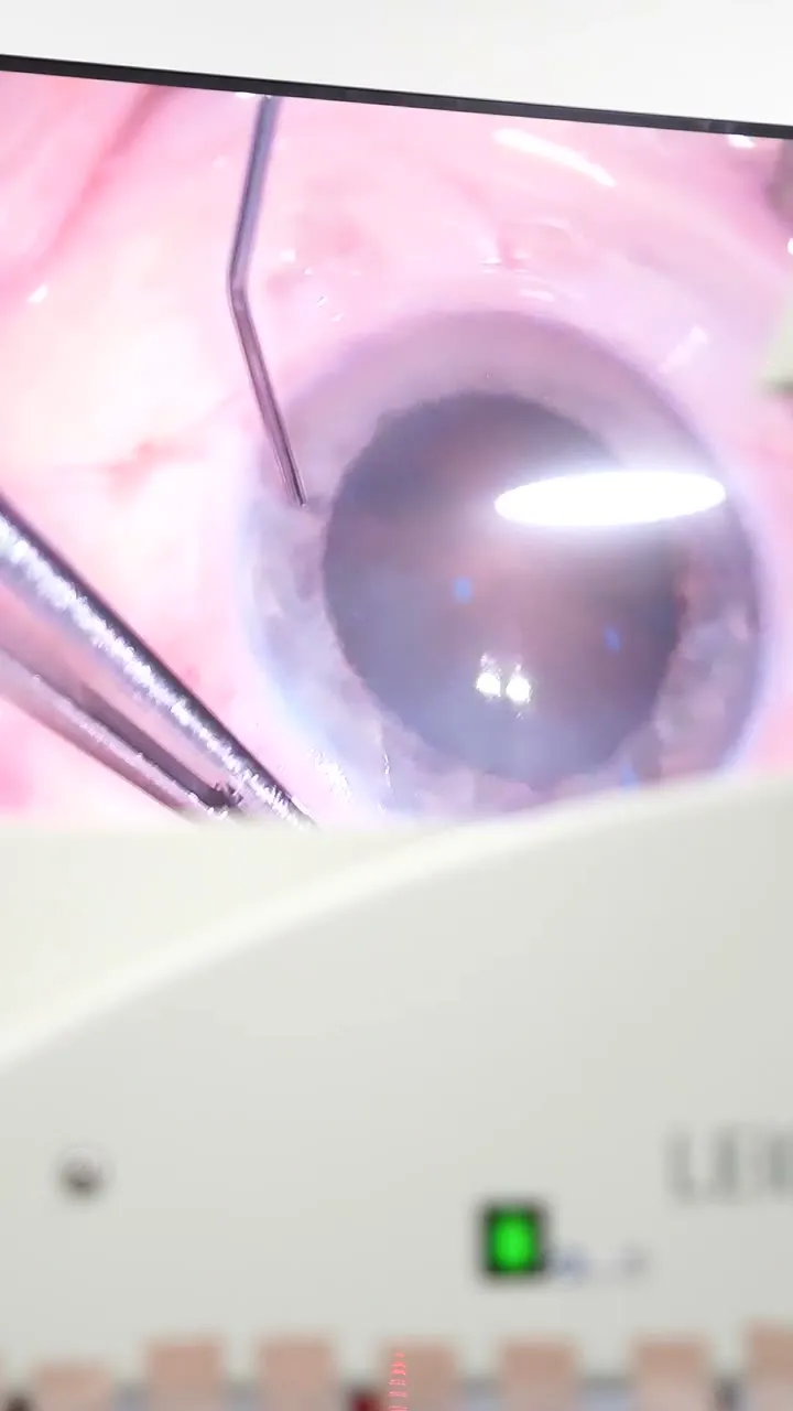 Dr. César Hernández Chavarría — Quirófano. Imágenes reales de una cirugía ocular en EyeCare, desde el microscopio hasta el detalle del ojo.